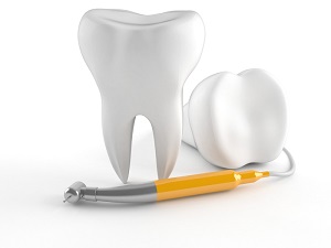 https://www.dubbodentistry.com.au/wp-content/uploads/2018/02/Root-Canal-Therapy.jpg