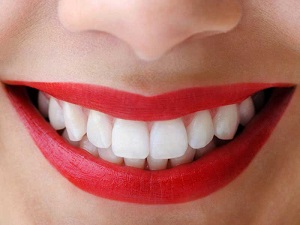 https://www.dubbodentistry.com.au/wp-content/uploads/2018/02/Teeth-Whitening.jpg